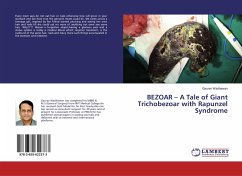 BEZOAR ¿ A Tale of Giant Trichobezoar with Rapunzel Syndrome
