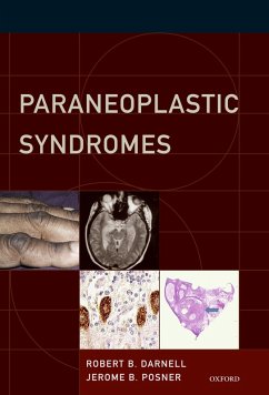 Cover Paraneoplastic Syndromes (eBook, PDF)
