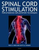 Spinal Cord Stimulation (eBook, PDF)