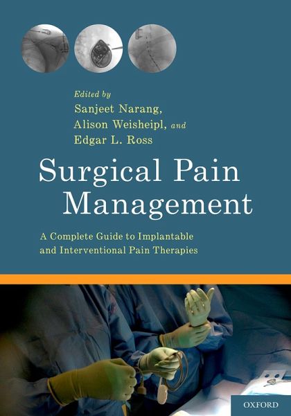 Surgical Pain Management (eBook, PDF) Surgical Pain Management (eBook, PDF)