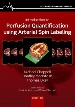 Introduction to Perfusion Quantification using Arterial Spin Labelling (eBook, PDF) - Chappell, Michael; Macintosh, Bradley; Okell, Thomas