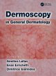 Dermoscopy in General Dermatology - Bild 1