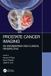 Prostate Cancer Imaging - Bild 1