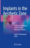 Implants in the Aesthetic Zone (eBook, PDF)