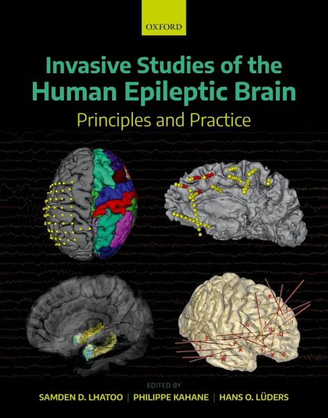 Invasive Studies of the Human Epileptic Brain (eBook, PDF) Invasive Studies of the Human Epileptic Brain (eBook, PDF)