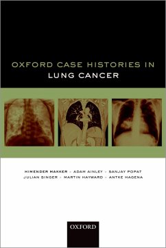 Oxford Case Histories in Lung Cancer (eBook, PDF) - Makker, Himender K.; Ainley, Adam; Popat, Sanjay; Singer, Julian; Hayward, Martin; Hagena, Antke