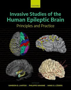 Cover Invasive Studies of the Human Epileptic Brain (eBook, ePUB)
