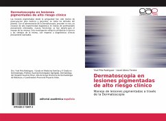 Dermatoscopia en lesiones pigmentadas de alto riesgo clínico - Piña Rodriguez, Yisel;Abreu Fereira, Lisset
