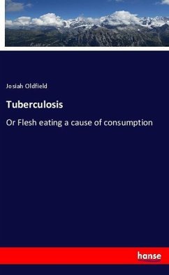 Tuberculosis - Oldfield, Josiah