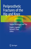 Periprosthetic Fractures of the Hip and Knee (eBook, PDF)