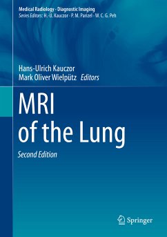 MRI of the Lung (eBook, PDF)