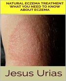 Natural Eczema Treatment (eBook, ePUB)