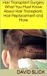Hair Transplant Surgery (eBook, ePUB) - Bild 1
