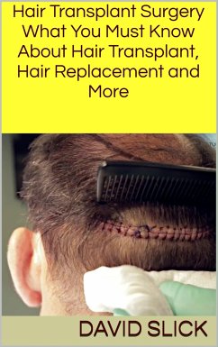 Hair Transplant Surgery (eBook, ePUB) - Slick, David