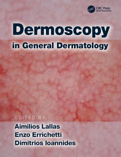 Dermoscopy in General Dermatology (eBook, ePUB)