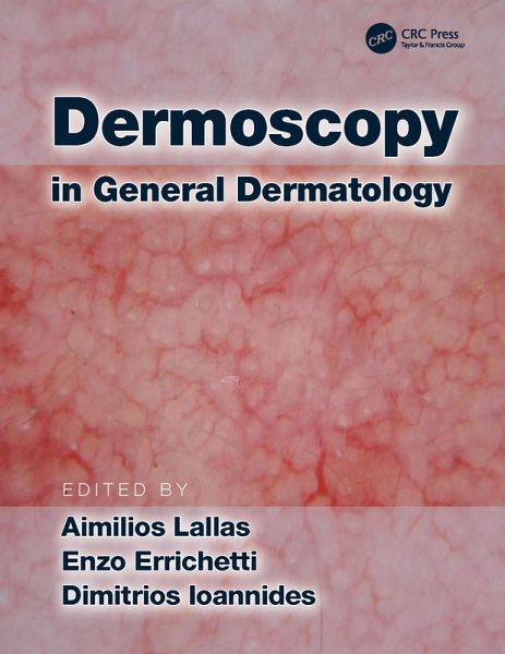 Dermoscopy in General Dermatology (eBook, ePUB) Dermoscopy in General Dermatology (eBook, ePUB)