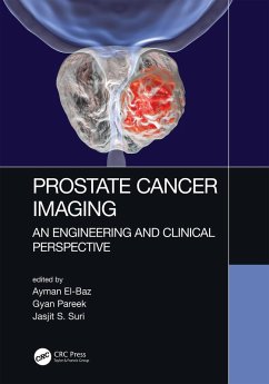 Cover Prostate Cancer Imaging (eBook, PDF)