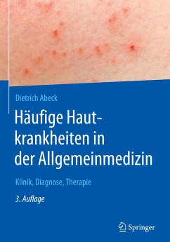 Häufige Hautkrankheiten in der Allgemeinmedizin - Abeck, Dietrich