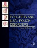 Pouchitis and Ileal Pouch Disorders (eBook, ePUB)