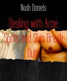 Dealing with Acne Spots and Skin Break Outs (eBook, ePUB)