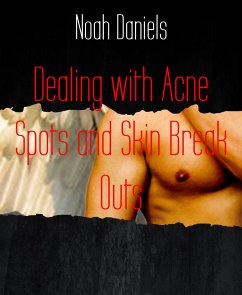 Dealing with Acne Spots and Skin Break Outs (eBook, ePUB) - Daniels, Noah