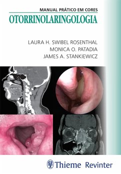 Otorrinolaringologia (eBook, ePUB) - Rosenthal, Laura H. Swibel; Patadia, Monica O.; Stankiewicz, James A.