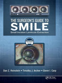 The Surgeon's Guide to SMILE - Reinstein, Dan; Archer, Timothy; Carp, Glenn