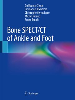 Bone SPECT/CT of Ankle and Foot (eBook, PDF) - Chuto, Guillaume; Richelme, Emmanuel; Cermolacce, Christophe; Nicaud, Michel; Puech, Bruno