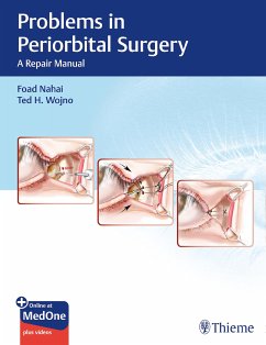 Problems in Periorbital Surgery (eBook, PDF) - Nahai, Foad; Wojno, Ted H.