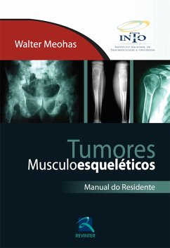 Tumores Musculoesqueléticos (eBook, ePUB) - Meohas, Walter