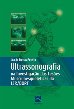 Ultrassonografia na Investigação das Lesões Musculoesqueléticas Ler/Dort (eBook, ePUB) - Pereira, Léa de Freitas