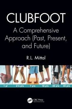 Clubfoot - Mittal, R L