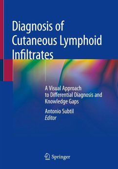 Diagnosis of Cutaneous Lymphoid Infiltrates - Subtil, Antonio