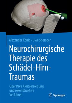 Neurochirurgische Therapie des Schädel-Hirn-Traumas (eBook, PDF) - König, Alexander; Spetzger, Uwe