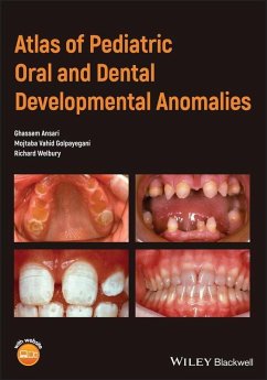 Atlas of Pediatric Oral and Dental Developmental Anomalies (eBook, PDF) - Ansari, Ghassem; Golpayegani, Mojtaba Vahid; Welbury, Richard