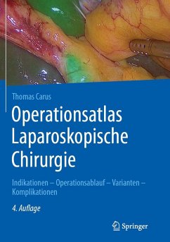 Operationsatlas Laparoskopische Chirurgie - Carus, Thomas