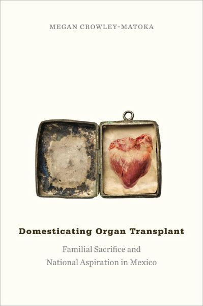 Domesticating Organ Transplant (eBook, PDF) Domesticating Organ Transplant (eBook, PDF)