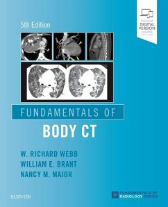 Fundamentals of Body CT - Webb, W Richard, MD (Professor Emeritus of Radiology and Biomedical ; Brant, Wiliam E. (Professor Emeritus, Department of Radiology and Me; Major, Nancy M. (Professor of Radiology and Orthopedics, University