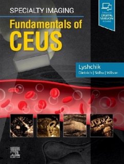 Specialty Imaging: Fundamentals of CEUS - Lyshchik, Andrej