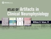 Atlas of Artifacts in Clinical Neurophysiology (eBook, ePUB) Atlas of Artifacts in Clinical Neurophysiology (eBook, ePUB)