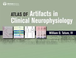 Atlas of Artifacts in Clinical Neurophysiology (eBook, ePUB) - Tatum, William O.