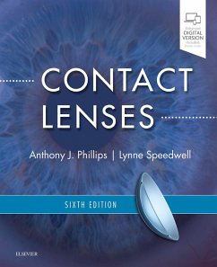 Cover Contact Lenses (eBook, ePUB)