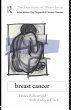 Breast Cancer (eBook, PDF) - Bild 1