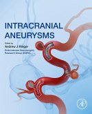 Intracranial Aneurysms (eBook, ePUB)
