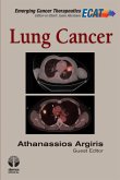 Lung Cancer (eBook, ePUB)