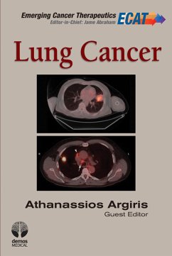 Lung Cancer (eBook, ePUB)