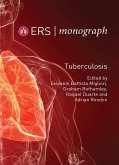 Lung Microbiome (eBook, PDF) Lung Microbiome (eBook, PDF)