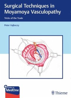 Surgical Techniques in Moyamoya Vasculopathy - Vajkoczy, Peter