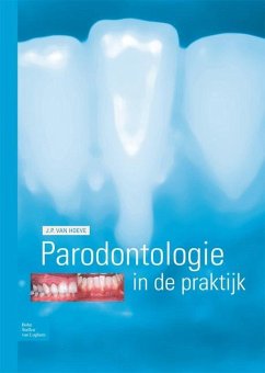 Parodontologie in de Praktijk - Hoeve, J P van
