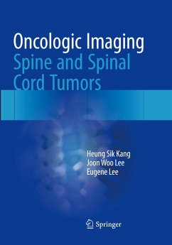 Oncologic Imaging: Spine and Spinal Cord Tumors - Kang, Heung Sik;Lee, Joon Woo;Lee, Eugene